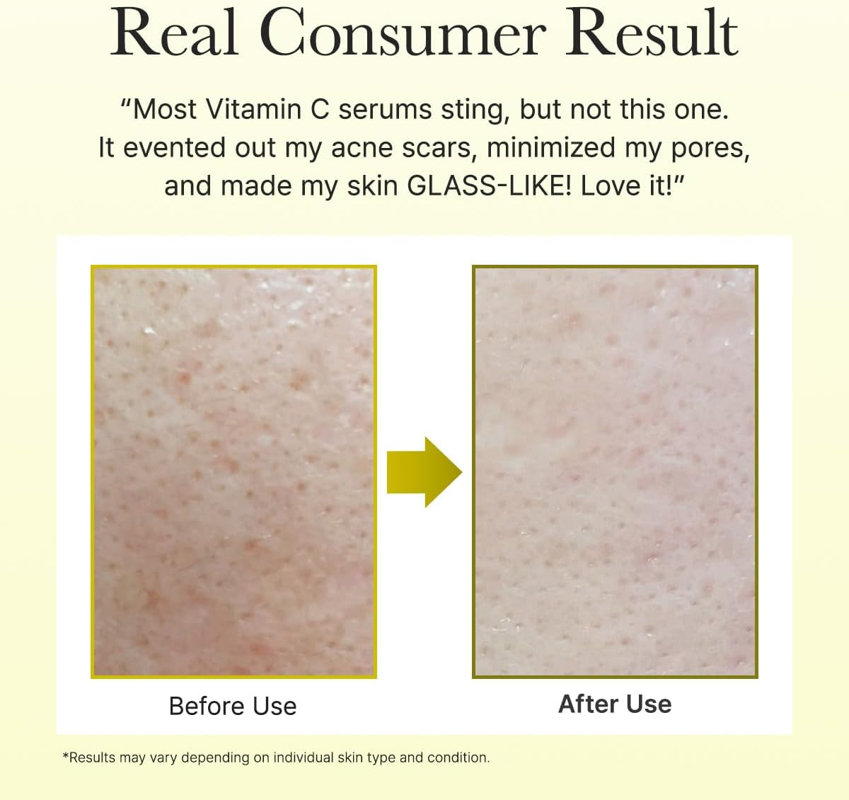 Vitamin C Booster Serum